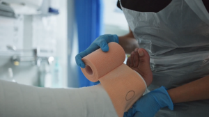 Image of a nurse wrapping a patient's lower limb in compression dressings.